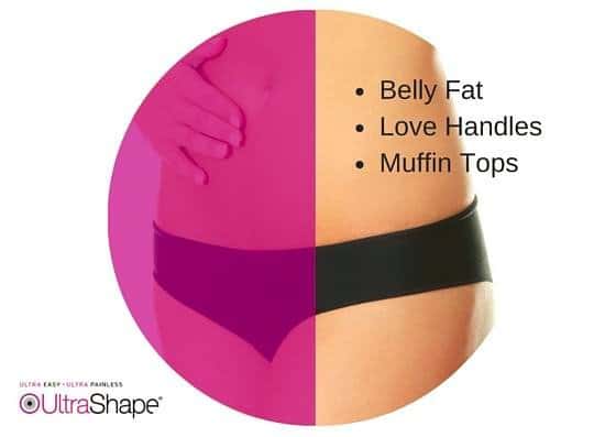 How to Get Rid of Fat in a "Problem Area" of Your Body UltraShape4-560x397-1