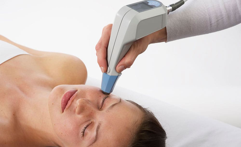 Laser Facial Elite-Facelift-Exilis-Laser-Facial