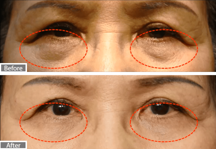 Face Treatments TransfirmSkin