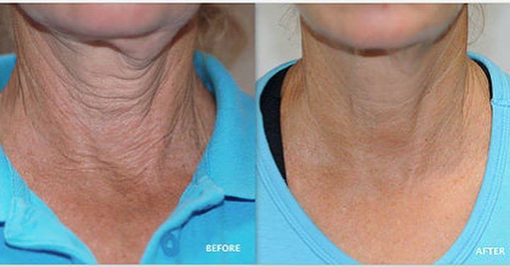 Face Treatments TransfirmSkin