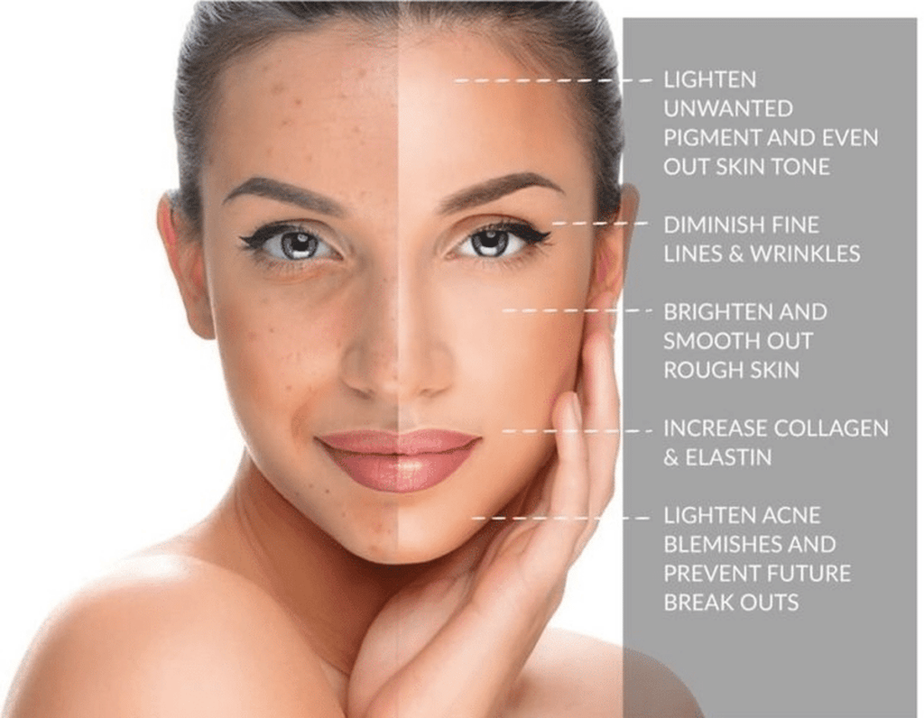 Facial Peel - Bio-Revitalization Glow chemical-peels-PRX-Unicorn-1024x796